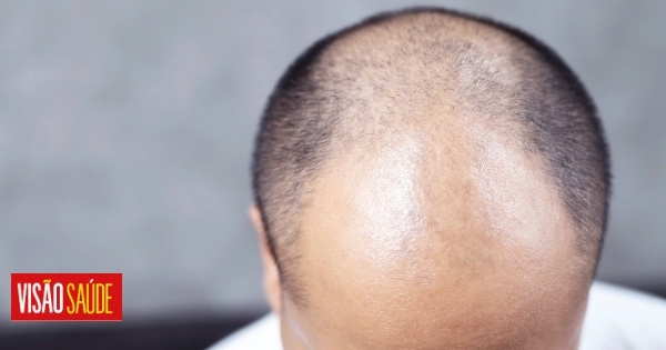 Les anciens médicaments pour la tension artérielle peuvent être la solution à la perte de cheveux.  Et à un prix intéressant